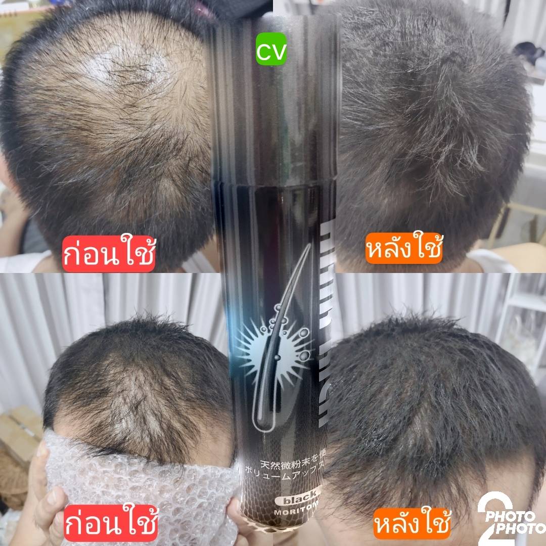 ผมดกดำ ผมหนา ทำได้เพียง 1 นาที ด้วยสเปร์เคลือบผม เสริมสร้างบุคลิค และเพิ่มความมั่นใจ