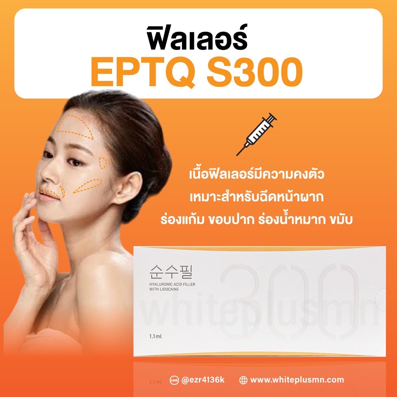 EPTQ S300