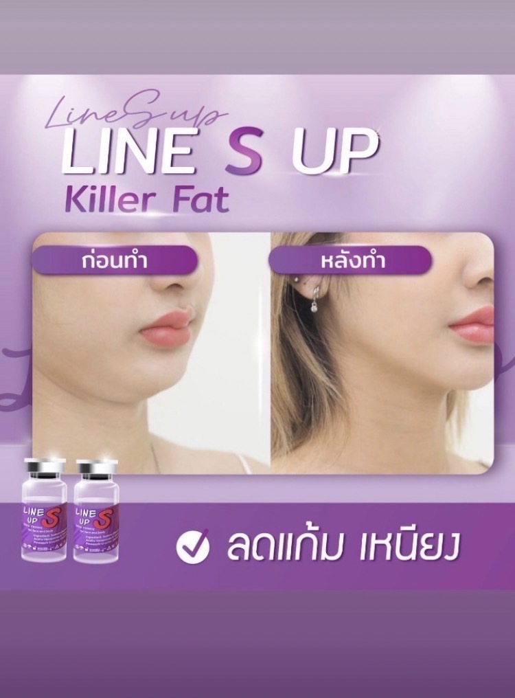 Line s up meso fat ( ราคายกกล่อง )