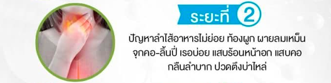 อาการกรดไหลย้อนขั้น2