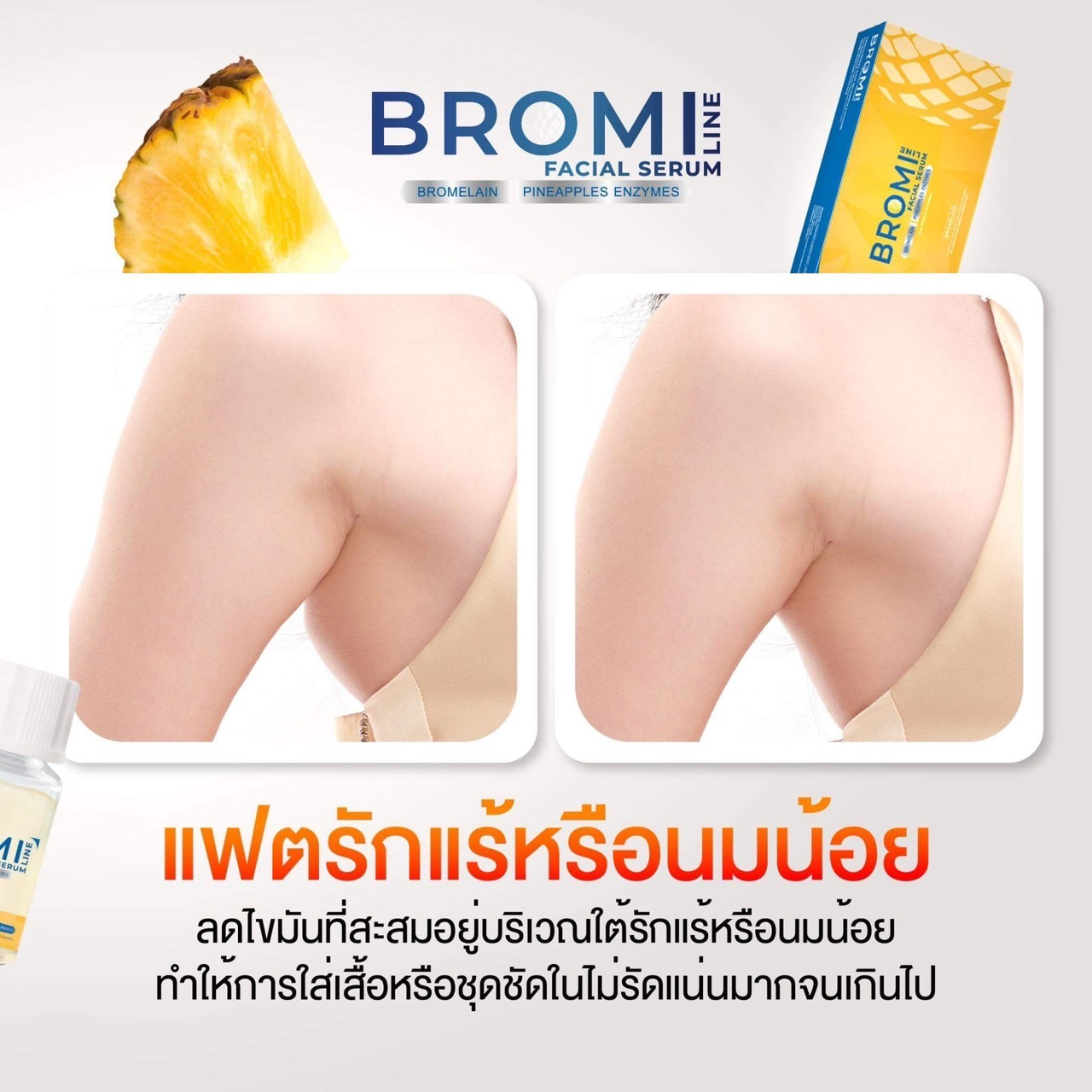 Mesofat bromi line อย.ไทย ( ราคายกกล่อง )