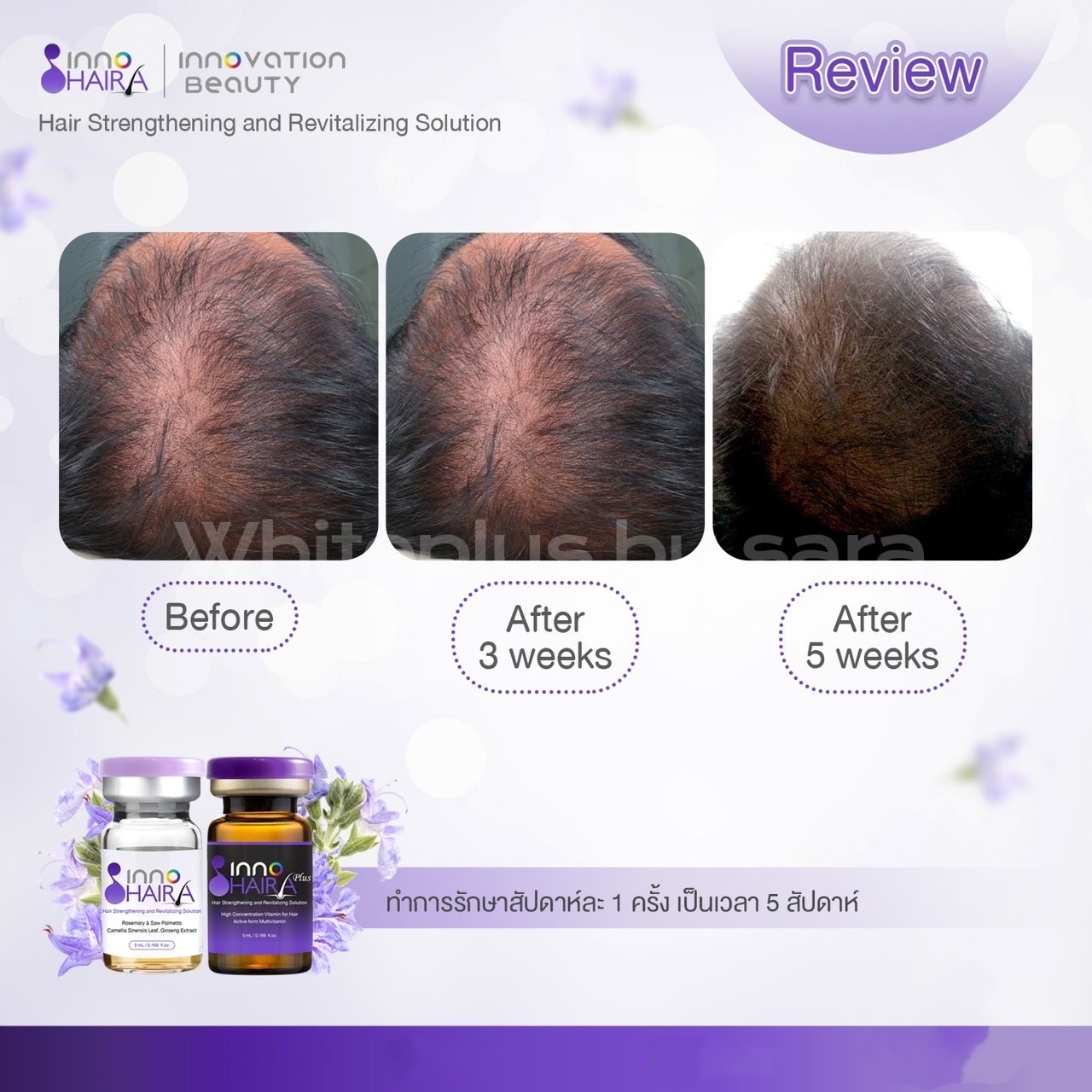 INNO HAIR อย.ไทย ราคาต่อขวด