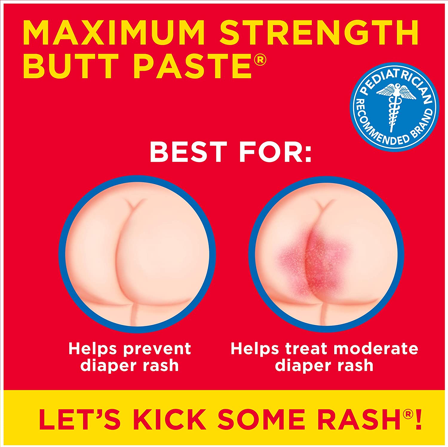 Boudreaux's Butt Paste Maximum Strength Diaper Rash Ointment ครีมบรรเทาอาการผื่นผ้าอ้อม