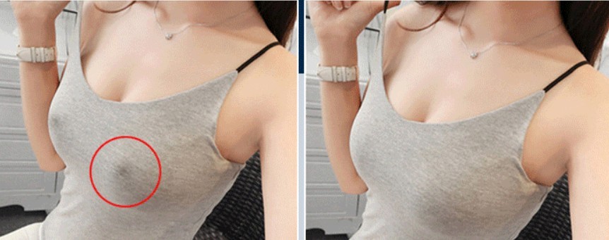 ซิลิโคนปิดจุก กาวแน่น ถนอมผิว กันน้ำ กันเหงื่อ ขนาด 6.5 และ 8 มี 2 แบบ 4 สี