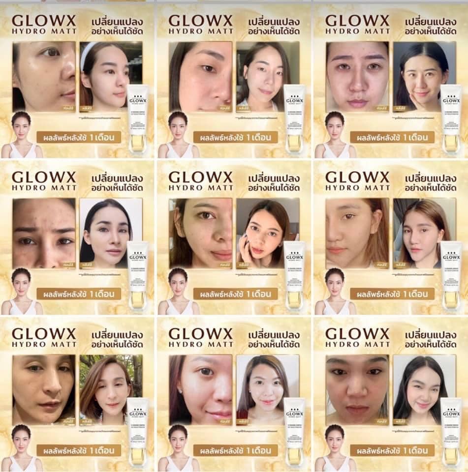 รีวิว GlowX, GlowX ราคา, ครีมแต้ว,
