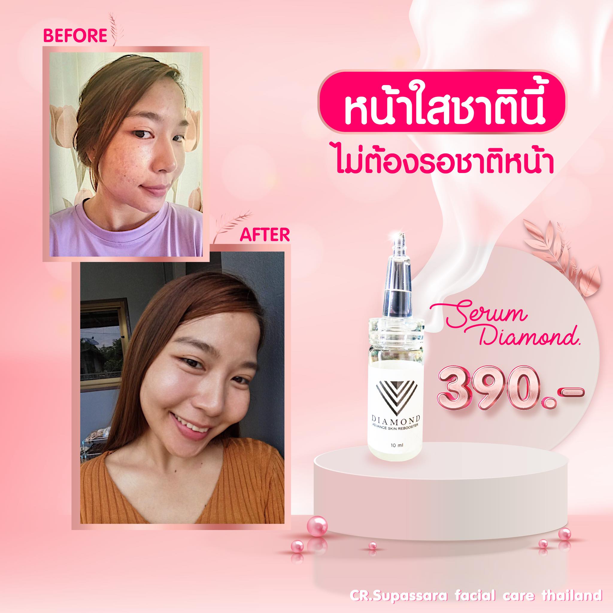 Diamond advance skin rebooster