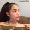🍁 BOTOX โบท็อก