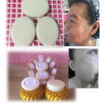 สบู่ GP สูตรกำจัดฝ้า กระ (Pellicle treatment)